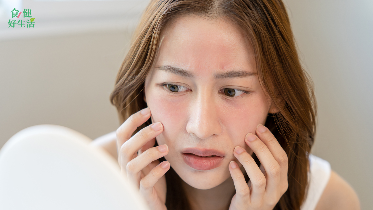 換季成敏感肌地獄?營養師:吃這些才穩膚! 4 皮膚過敏